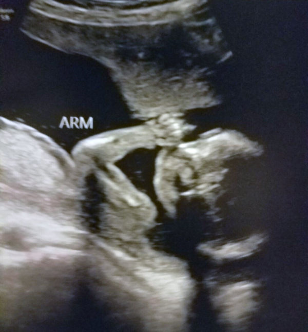 ultrasound-2019